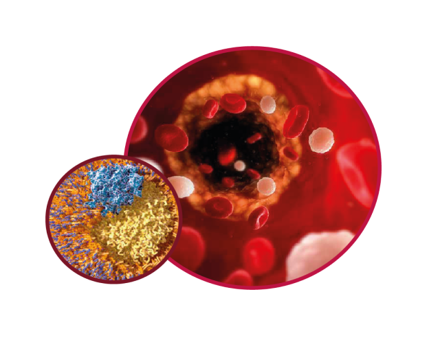 Medical Digest Lipidology