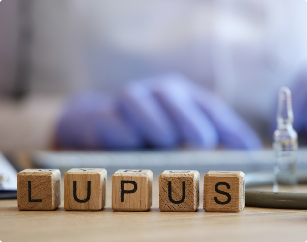 Recomendaciones EULAR/ERA-EDTA sobre nefritis lúpica