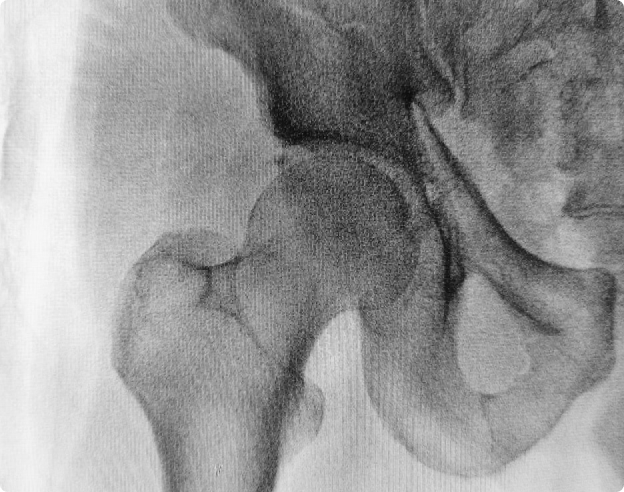 Osteoartritis: Casos Clínicos