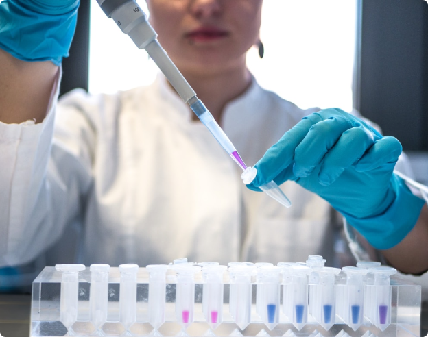 The serum-based MASEF for the non-invasive identification of patients with NASH and significant fibrosis