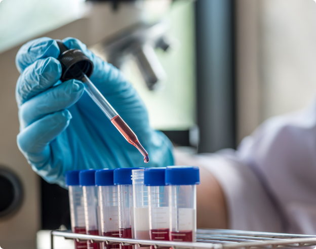 Mejore el control sobre el RCV de sus pacientes con Liposcale®