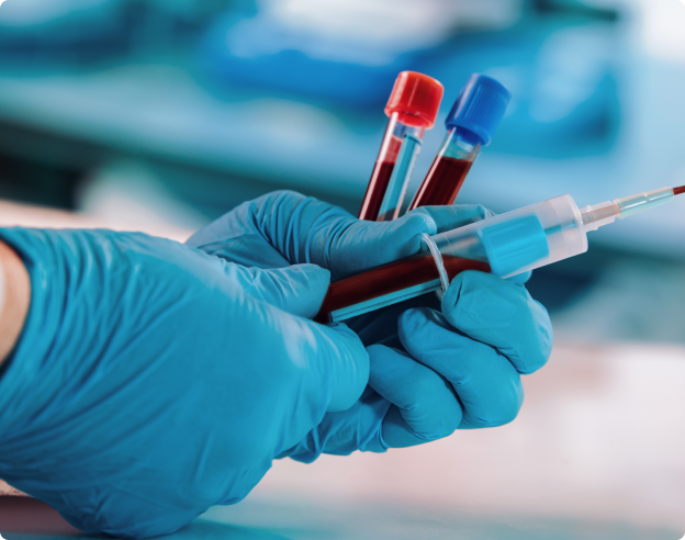 Cómo interpretar un informe Liposcale®