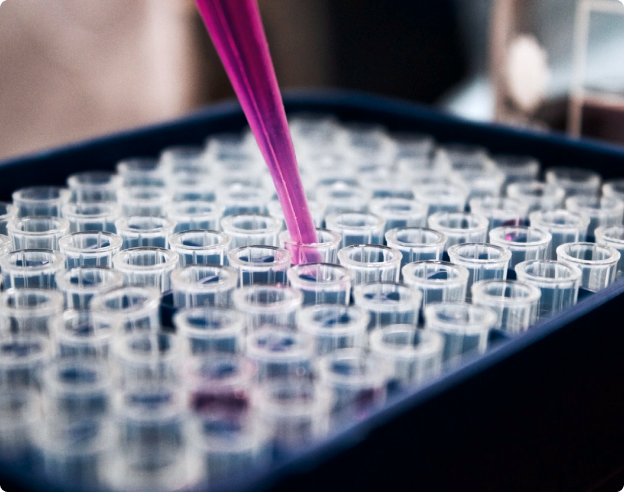 Ejemplo Informe Déficit HDL Liposcale®