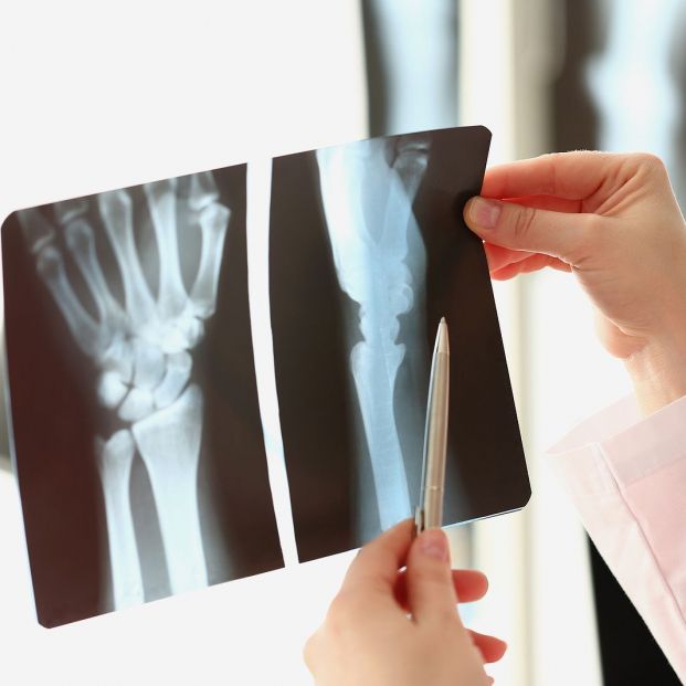 Xrays